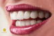 Invisible Aligners in Stockholm: The Future of Orthodontic Treatment