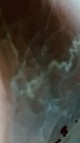 My eye